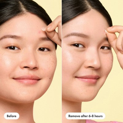 Hero Mighty Patch Invisible Mini 30ct - New