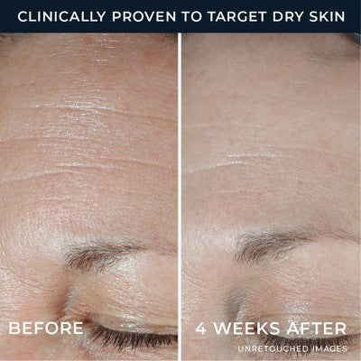 RoC Multi Correxion Hydration Night Moisturizer 1.7oz - Missing Box