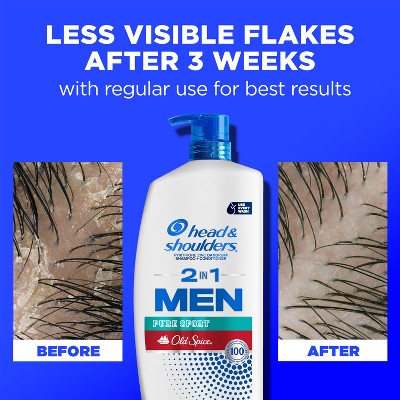 Head & Shoulders Men's 2-in-1 Shampoo and Conditioner, Anti-Dandruff Treatment, Old Spice Pure Sport for Daily Use, Paraben-Free 28.2 fl oz - Imperfect Container