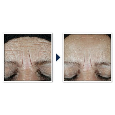 RoC Multi Correxion Hydrate + Plump Daily Moisturizer with Hyaluronic Acid SPF 30 1.7oz - Imperfect Box