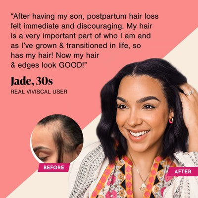 Viviscal Women's Hair Growth Supplement 60ct - Imperfect Box