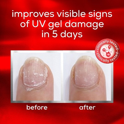 essie Nail Care To The Rescue UV Gel Damage Repair Nail Repair Treatment 0.46 fl oz - Imperfect Box