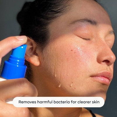 Magic Molecule Hypochlorous Acid Skin Spray 3.4 fl oz - Imperfect Box