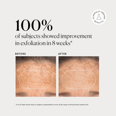 Naturium BHA Liquid Exfoliant 2% 4 fl oz - Imperfect Box