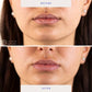 BioRepublic SkinCare Lip Masks  6pk - New