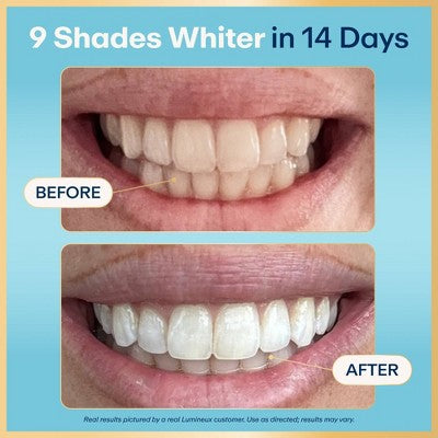 Lumineux Tooth Whitening Strips 14pk - Imperfect Box
