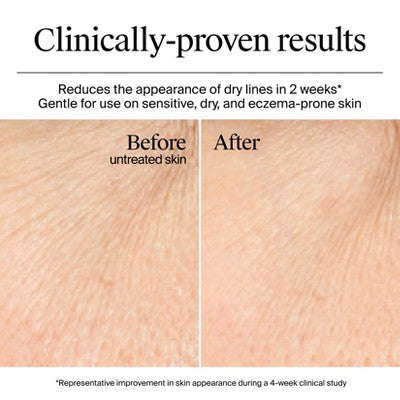 Neutrogena Hydro Boost Water Gel Cream Moisturizer 1.7 fl oz - Missing Box