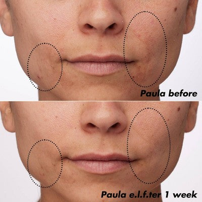 e.l.f. SKIN PLZ Clarify Facial Oil 2% Salicylic Acid Acne Treatment + Aloe Extract 1 fl oz - Imperfect Box