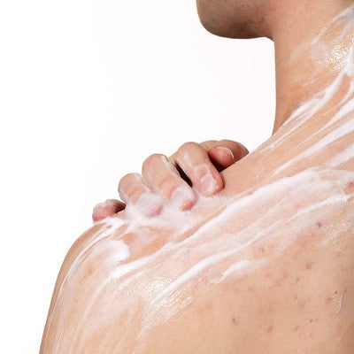 CeraVe Acne Control Foaming Face Cleanser 10% BPO 5 fl oz - Imperfect Box