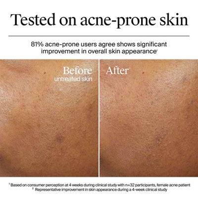 Neutrogena Hydro Boost Water Gel Cream Moisturizer 1.7 fl oz - Missing Box