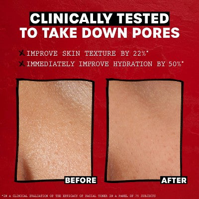 Thayers Remedies Witch Hazel Alcohol Free Lavender Facial Toner 12 fl oz - New